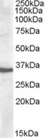 Apolipoprotein F Antibody in Western Blot (WB)