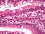 Apolipoprotein B Antibody in Immunohistochemistry (Paraffin) (IHC (P))