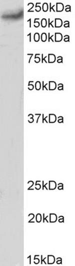 CaV1.2 Antibody in Western Blot (WB)