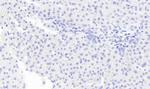 Monoacylglycerol Lipase Antibody in Immunohistochemistry (Paraffin) (IHC (P))