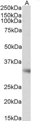 Monoacylglycerol Lipase Antibody in Western Blot (WB)