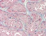 SFRP1 Antibody in Immunohistochemistry (Paraffin) (IHC (P))