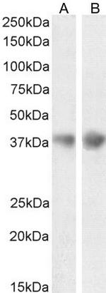 Apolipoprotein J Antibody in Western Blot (WB)