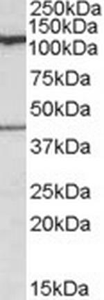 COG1 Antibody in Western Blot (WB)