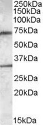 LIPG Antibody in Western Blot (WB)