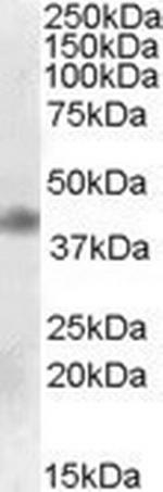 MEIS1 Antibody in Western Blot (WB)