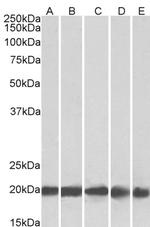 Ferritin Light Chain Antibody in Western Blot (WB)