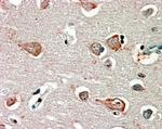 GABRB3 Antibody in Immunohistochemistry (Paraffin) (IHC (P))