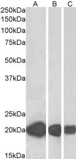 CSRP3 Antibody in Western Blot (WB)