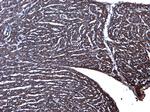 Desmin Antibody in Immunohistochemistry (Paraffin) (IHC (P))