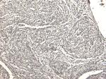 Desmin Antibody in Immunohistochemistry (Paraffin) (IHC (P))