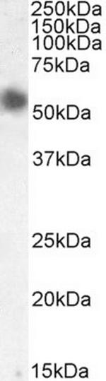 Desmin Antibody in Western Blot (WB)