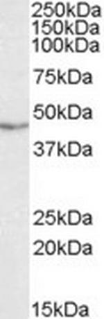 TDP-43 Antibody in Western Blot (WB)