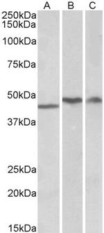 TDP-43 Antibody in Western Blot (WB)