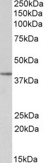 SFRP4 Antibody in Western Blot (WB)