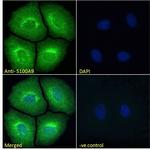 S100A9 Antibody in Immunocytochemistry (ICC/IF)