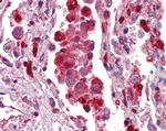 S100A9 Antibody in Immunohistochemistry (Paraffin) (IHC (P))