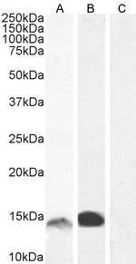 S100A9 Antibody in Western Blot (WB)