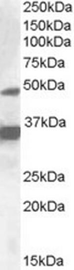 PXR Antibody in Western Blot (WB)