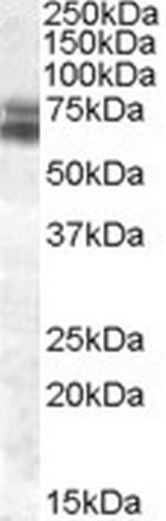 BMAL1 Antibody in Western Blot (WB)