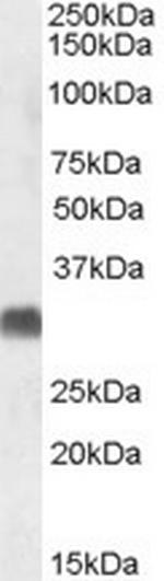 SRD5A2 Antibody in Western Blot (WB)