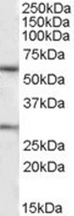 KCNQ1 Antibody in Western Blot (WB)