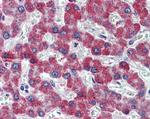 PAR1 Antibody in Immunohistochemistry (Paraffin) (IHC (P))