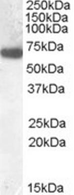 GCKR Antibody in Western Blot (WB)