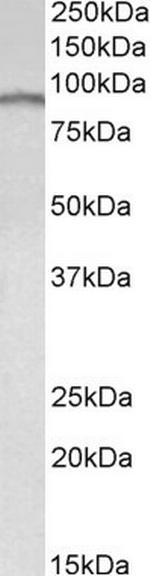 E2F7 Antibody in Western Blot (WB)