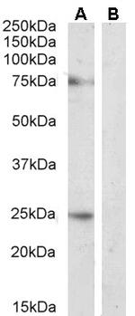 DLL1 Antibody in Western Blot (WB)