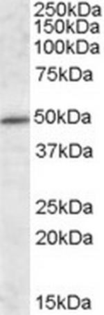 HIPPI Antibody in Western Blot (WB)