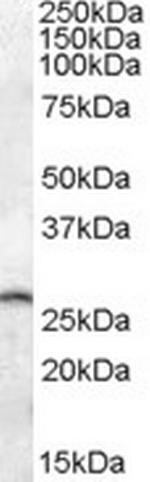 PSPH Antibody in Western Blot (WB)