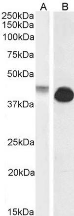 Connexin 43 Antibody in Western Blot (WB)