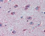 FMRP Antibody in Immunohistochemistry (Paraffin) (IHC (P))