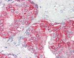 Prostate Specific Acid Phosphatase Antibody in Immunohistochemistry (Paraffin) (IHC (P))