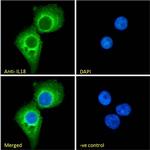 IL-18 Antibody in Immunocytochemistry (ICC/IF)