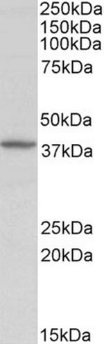 Decorin Antibody in Western Blot (WB)