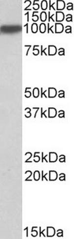 Aconitase 1 Antibody in Western Blot (WB)