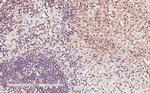 CD11a Antibody in Immunohistochemistry (Paraffin) (IHC (P))