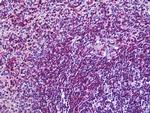 CD11a Antibody in Immunohistochemistry (Paraffin) (IHC (P))