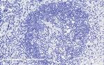 CD11a Antibody in Immunohistochemistry (Paraffin) (IHC (P))