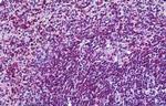 CD11a Antibody in Immunohistochemistry (Paraffin) (IHC (P))