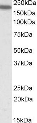 CD11a Antibody in Western Blot (WB)