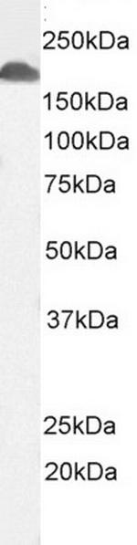 CD11a Antibody in Western Blot (WB)