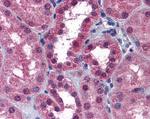 P2X7 Antibody in Immunohistochemistry (Paraffin) (IHC (P))