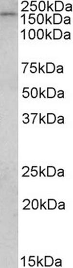 CLIP1 Antibody in Western Blot (WB)