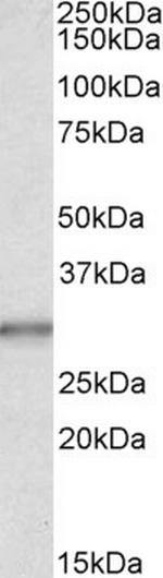 Carbonic Anhydrase I Antibody in Western Blot (WB)