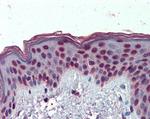 HMGA1 Antibody in Immunohistochemistry (Paraffin) (IHC (P))