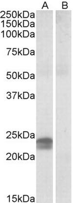 HMGA1 Antibody in Western Blot (WB)