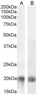 LIGHT Antibody in Western Blot (WB)